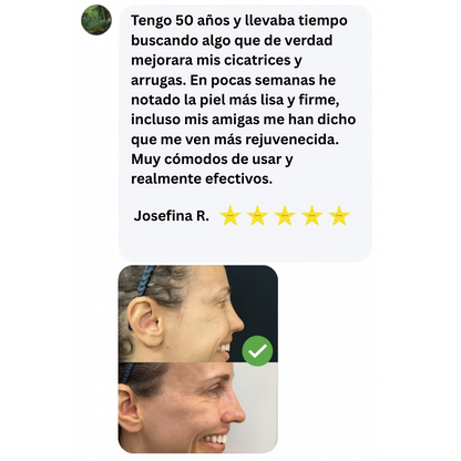 Eliminador de cicatrices