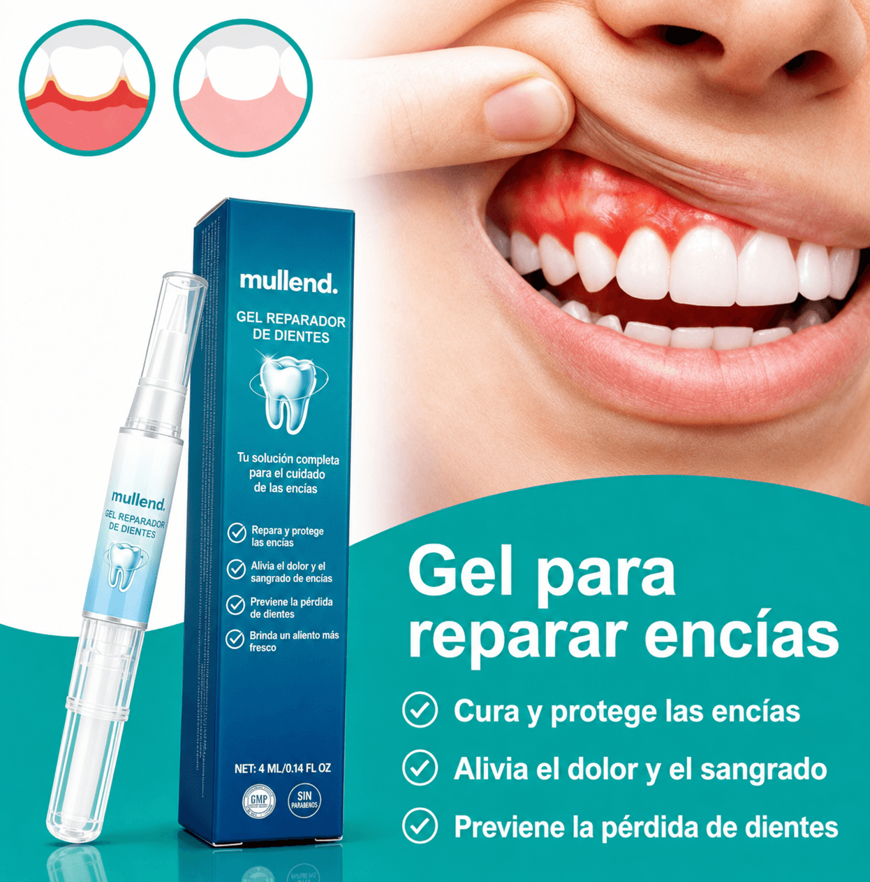 Gel para reparar encias