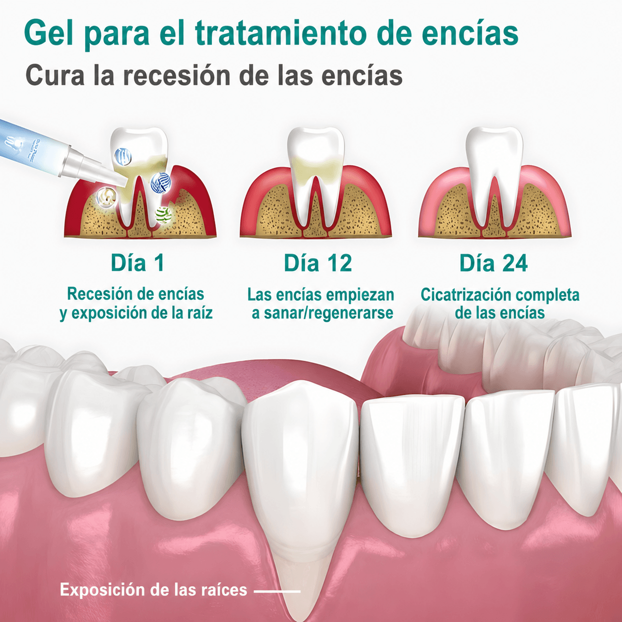 Gel para reparar encias